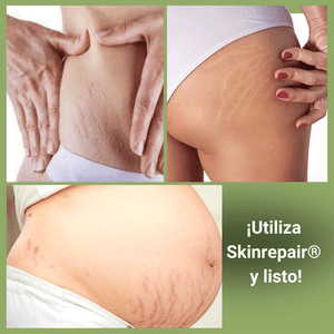 CREMA ANTIESTRÍAS SKINREPAIR